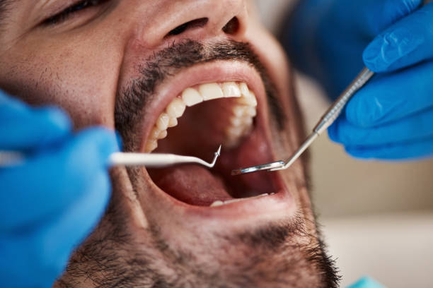 Best Emergency Treatment for Dental Infections or Abscesses in Gorman, NC